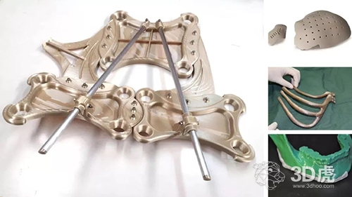 【探討】FDM 3D打印到底有沒(méi)有應(yīng)用性？(圖2)