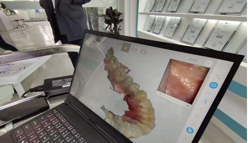  3D打印技術(shù)在牙科義齒領(lǐng)域中牙套制作的應(yīng)用是怎樣的呢？(圖2)